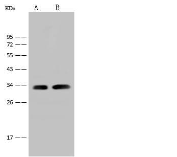 RPS6 / Ribosomal Protein S6 Antibody