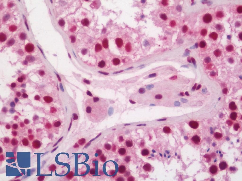 IHC-plus™ XRCC5 / Ku80 Antibody (clone 5C5)