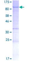 Human YTHDF1 Protein (Recombinant GST)