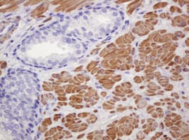 PADI4 / PAD4 Antibody (clone OTI5C10)