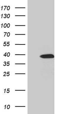 M-PST / STM Antibody (clone OTI2A9)