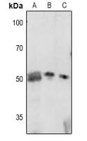 Polyclonal Rabbit anti-Human CDKN1C / p57 Kip2 Antibody (IHC, IF, WB)