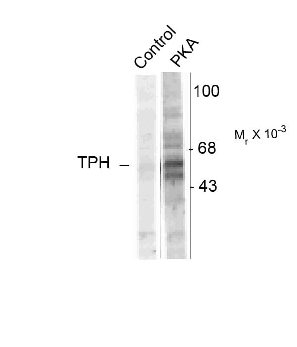 TPH1 / Tryptophan Hydroxylase Antibody (phospho-Ser58)
