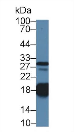 TNNC1 / Cardiac Troponin C Antibody (aa1-161)
