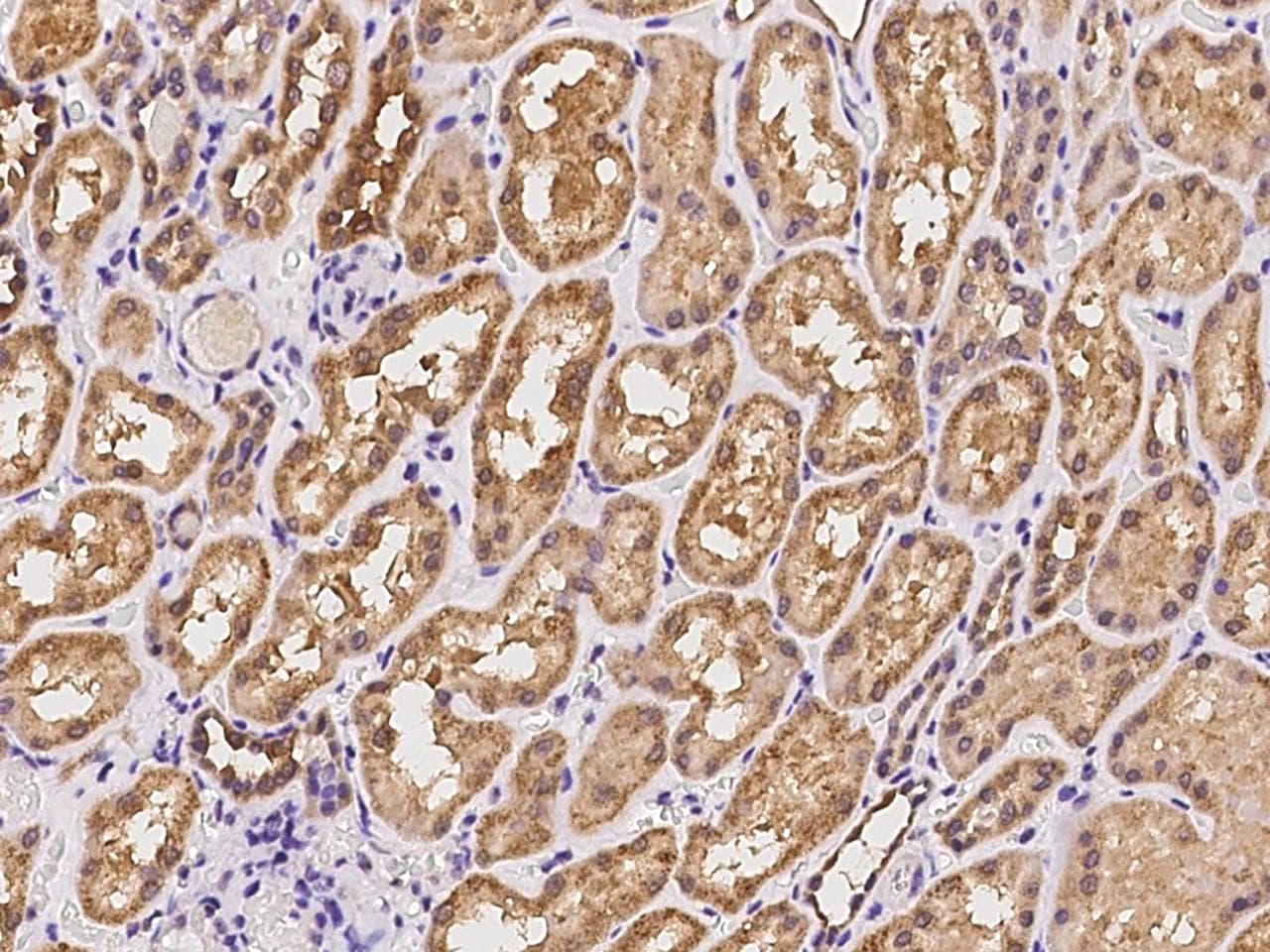 Polyclonal Rabbit anti-Human AKAP10 Antibody (IHC)