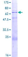 Human PDK3 Protein (Recombinant GST)