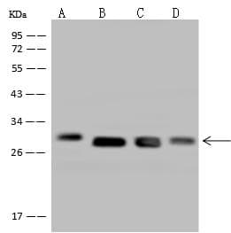Polyclonal Rabbit anti-Human DHRS4 / PSCD Antibody (IHC, WB)