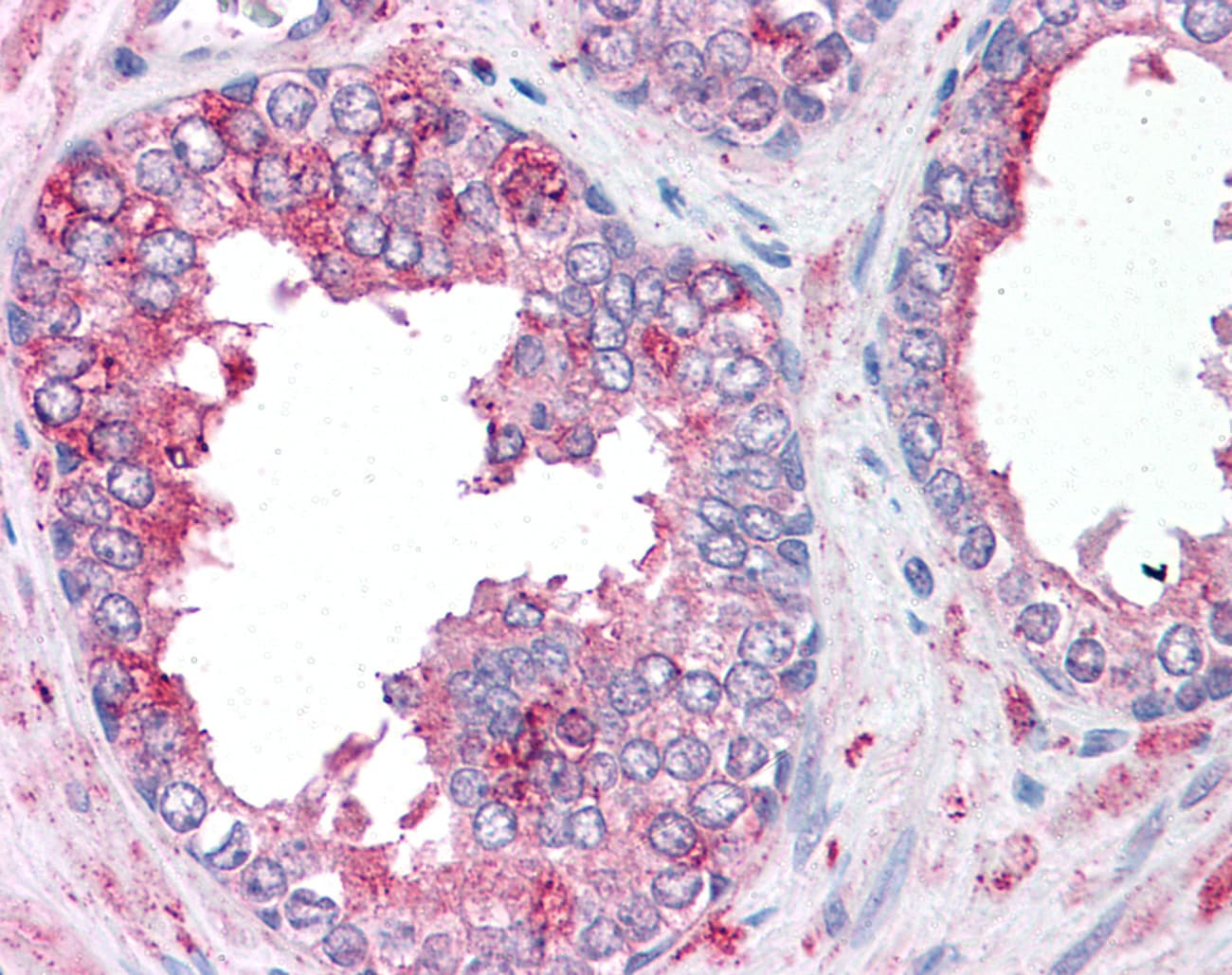 IHC-plus™ SLC39A6 / LIV-1 Antibody (Internal)