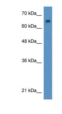 WT1 / Wilms Tumor 1 Antibody (N-Terminus)