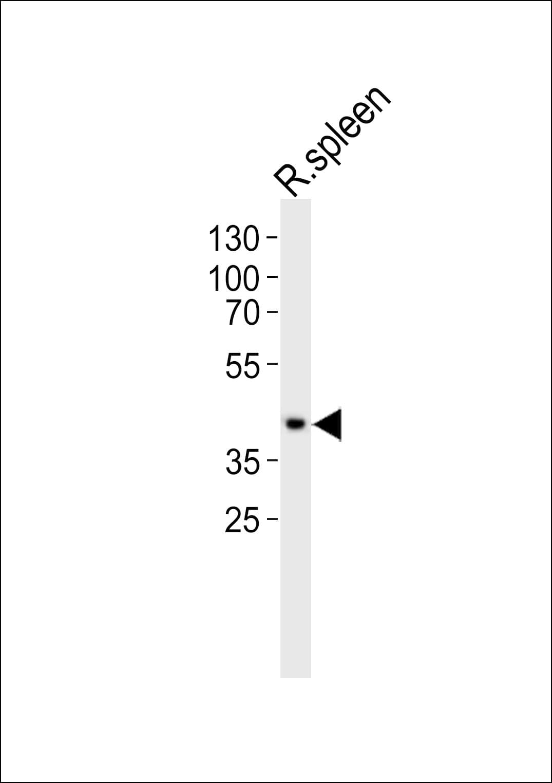 CCND3 / Cyclin D3 Antibody (aa33-66)