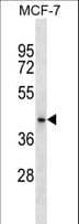 HAUS7 Antibody (aa4-33)
