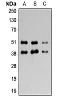 ADORA3 / Adenosine A3 Receptor Antibody (C-Terminus)