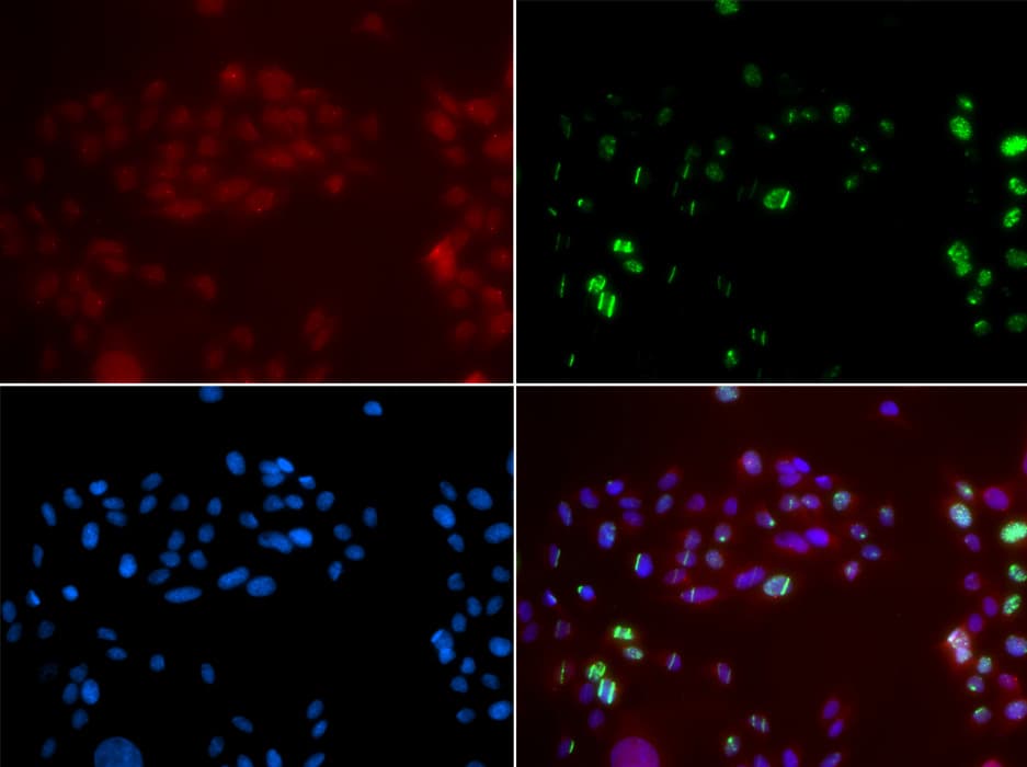 XPA Antibody