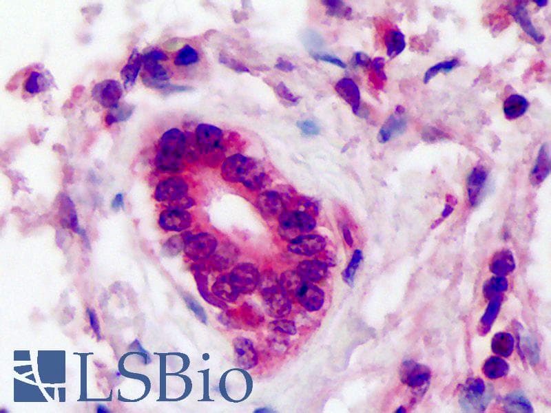 IHC-plus™ ARA9 / AIP Antibody (clone 35-2)
