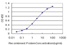 MKI67 / Ki67 Antibody (clone 7B8)
