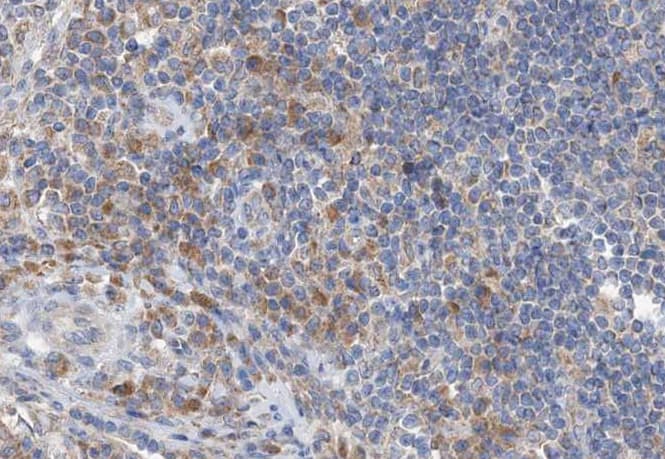 GZMB / Granzyme B Antibody