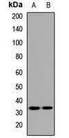 TREML1 / TLT1 Antibody