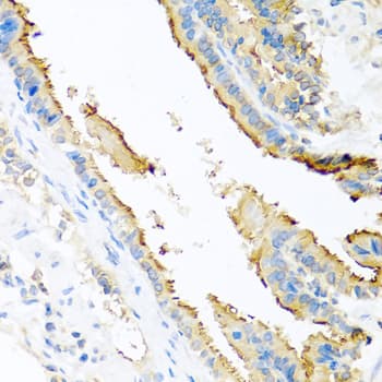 Polyclonal Rabbit anti-Human APOE / Apolipoprotein E Antibody (AP, IHC, IF)