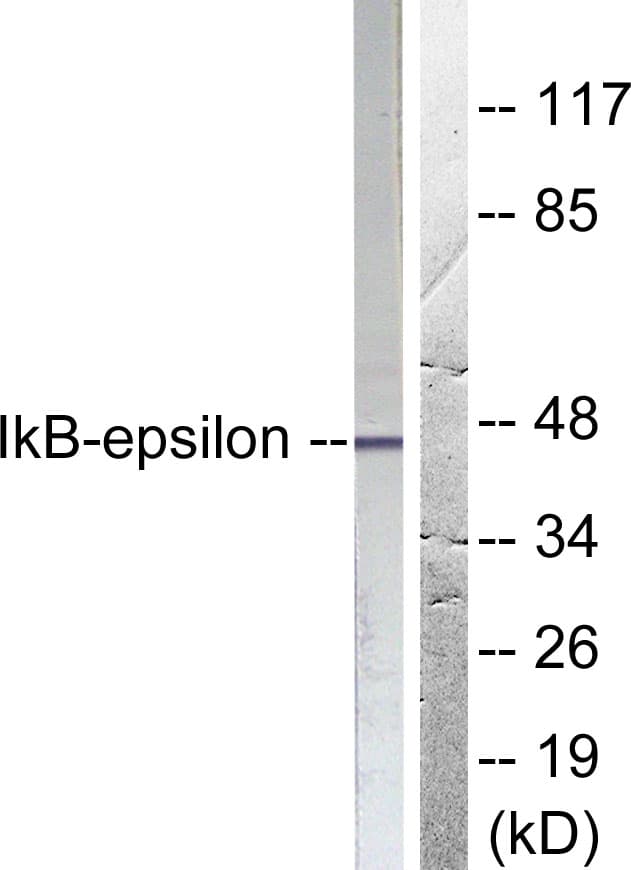 NFKBIE / IKB Epsilon Antibody (aa131-180)
