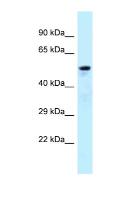 ARFGAP3 Antibody (aa377-426)