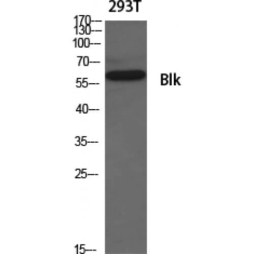 Polyclonal Rabbit anti-Human BLK Antibody (440-520 aa, IHC, WB)