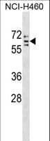 Polyclonal Rabbit anti-Human CYP4V2 Antibody (aa496-525, WB)