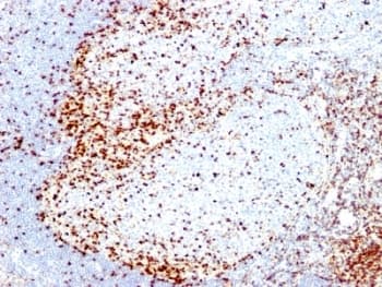 ZAP70 Antibody (clone 2F3.2)