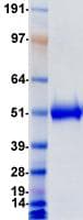 Human CD5 Protein (Recombinant DDK (Flag)-His, C-terminus)