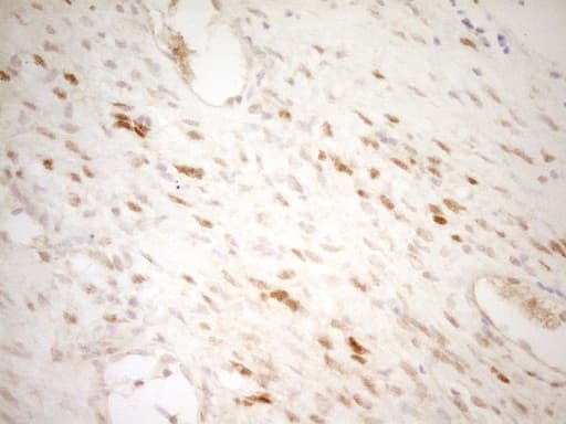 Monoclonal Mouse anti-Human THRA / THR Alpha Antibody (clone OTI3E10, aa1-220, IHC, WB)