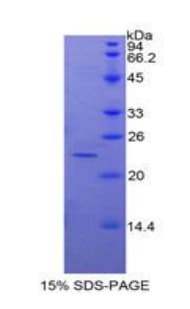 Chicken SPTAN1 / Alpha Fodrin Protein (Recombinant His)