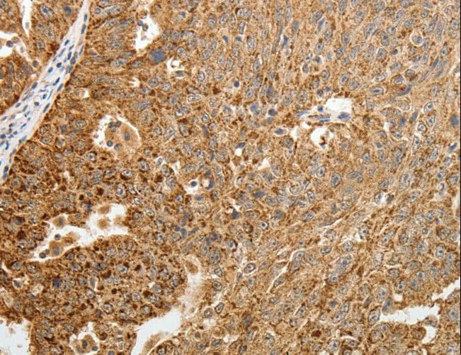 Polyclonal Rabbit anti-Human TFF2 / SP Antibody (IHC)