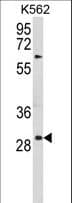 TSPAN20 / UPK1B Antibody (aa159-188)
