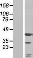 Human SDF1 / CXCL12 Protein (Over-Expression Lysate Myc-DDK (Flag))