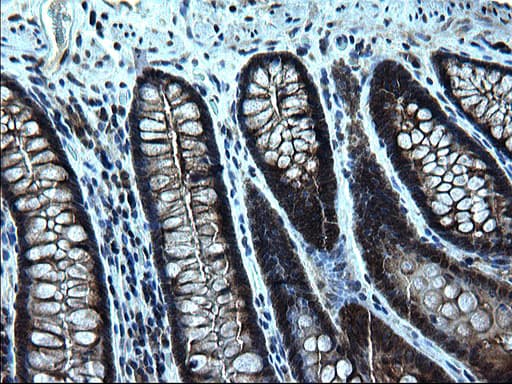 ZFAND3 / TEX27 Antibody (clone OTI1C5)