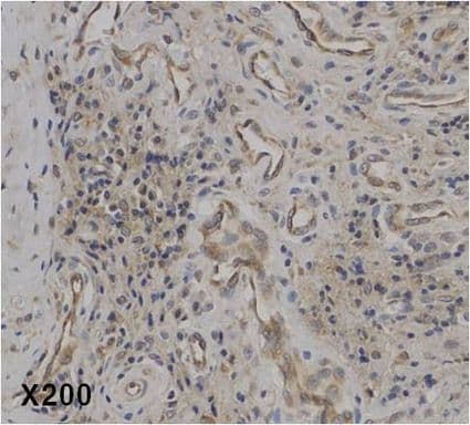IL37 Antibody