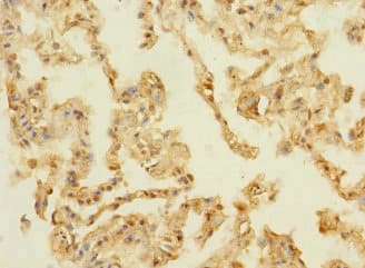 MPRG / PAQR5 Antibody