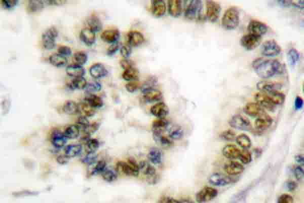SRF / Serum Response Factor Antibody (phospho-Ser103)