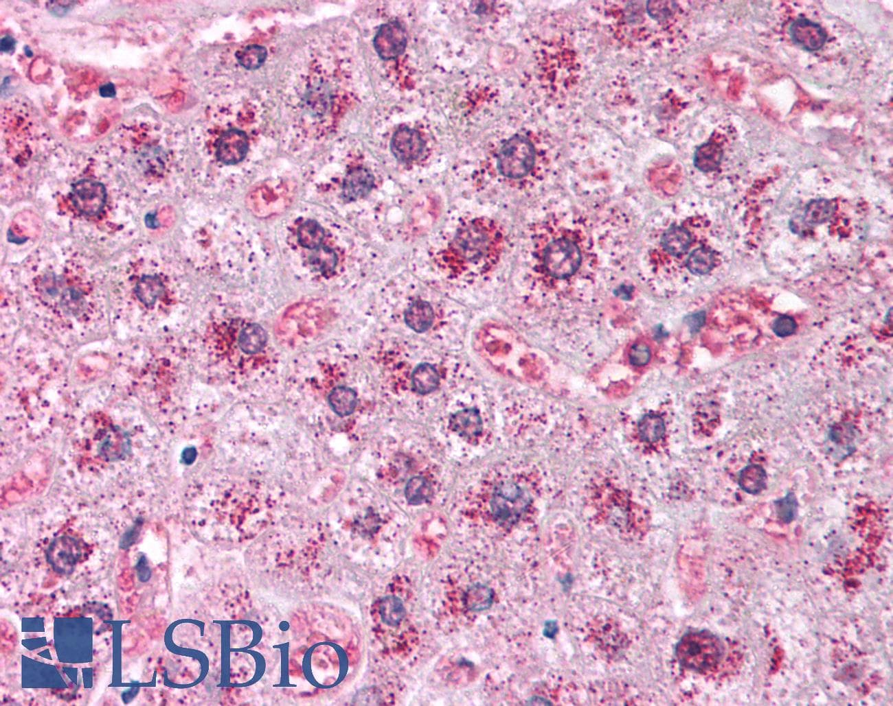 IHC-plus™ Polyclonal Rabbit anti-Bovine CAT / Catalase Antibody (IHC, WB)