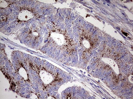 GBA / Glucosidase Beta Acid Antibody (aa40-315, clone UMAB171)