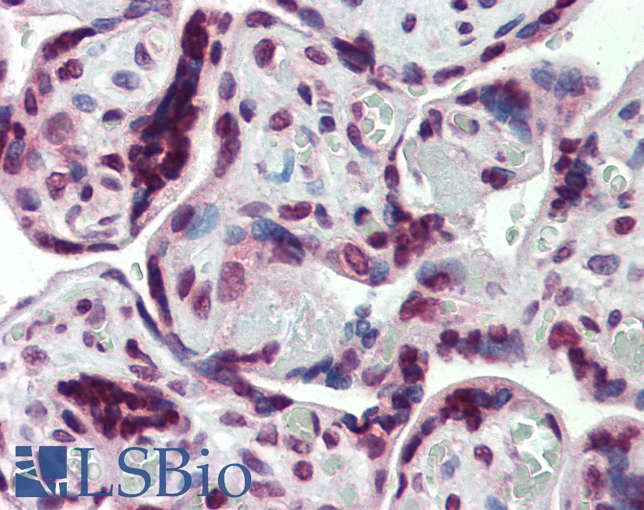 IHC-plus™ Polyclonal Rabbit anti-Human SHROOM2 Antibody (IHC, WB)