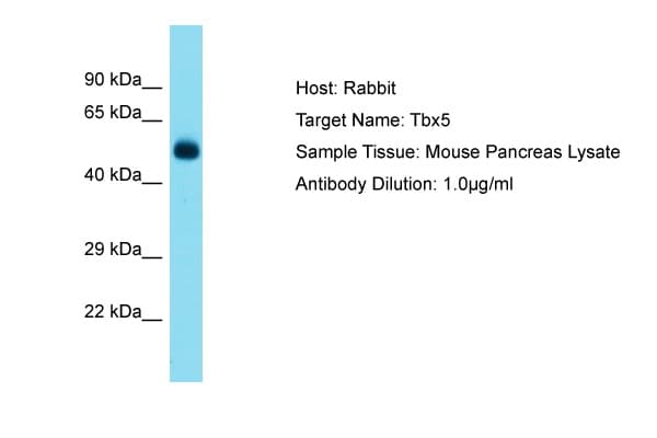 TBX5 Antibody (N-Terminus)