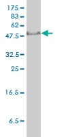 Monoclonal Mouse anti-Human TFB1 / GTF2H1 Antibody (clone 1F12-1B5, IF, WB)
