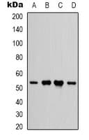 Polyclonal Rabbit anti-Human CD119 / IFNGR1 Antibody (Internal, WB)