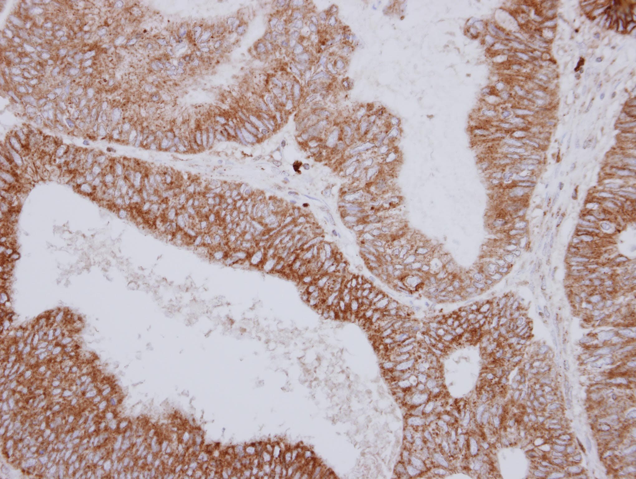 Polyclonal Rabbit anti-Human PNPT1 Antibody (aa25-251, IHC, WB)