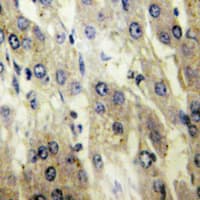 SLC27A5 / BACS Antibody (Internal)