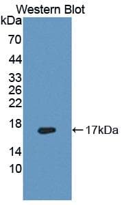 FADS3 Antibody (aa331-445, PE)