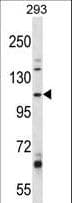 B4GALNT3 Antibody (aa555-584)
