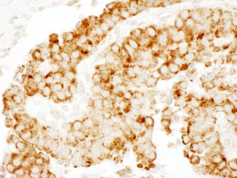 CKAP4 Antibody (aa500-550)