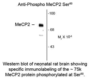 MECP2 Antibody (phospho-Ser80)