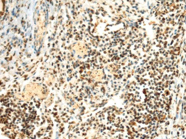 Polyclonal Rabbit anti-Human SEPHS1 / SPS Antibody (IHC)
